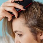 Say Goodbye to Scalp Psoriasis with These Proven Treatments
